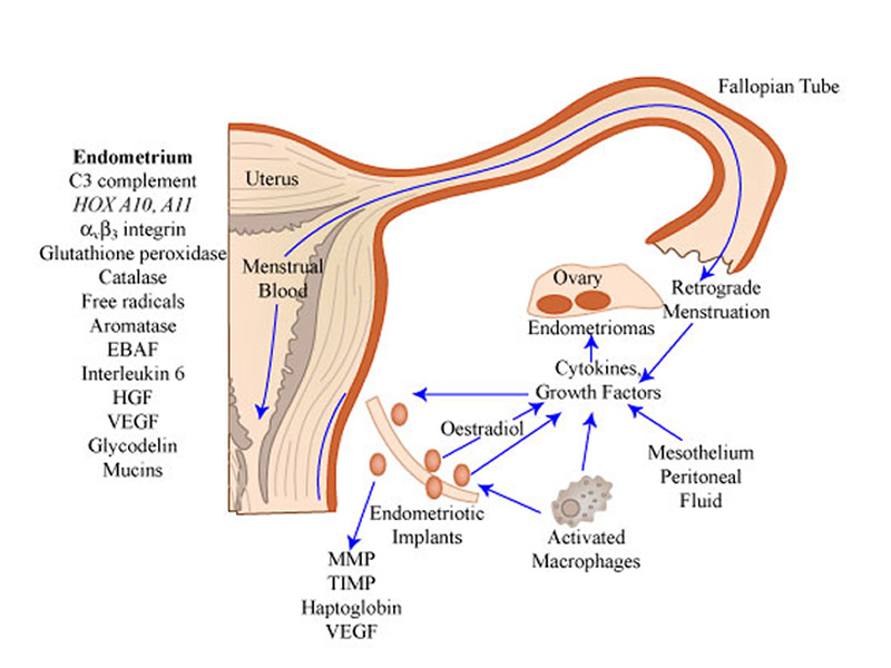 Endometriosis and Pelvic Pain | Foundation for Alternative and ...