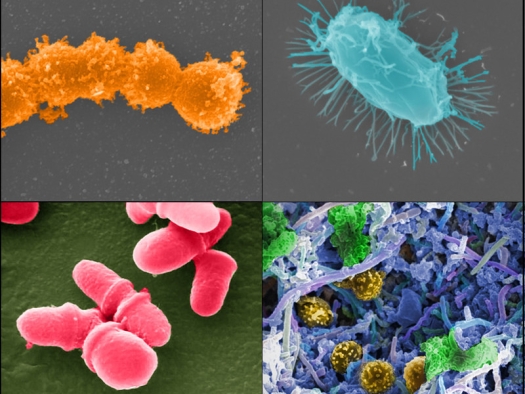Photos of different microbes: top right looks like a string of small orange pompoms; top right looks like a fuzzy aqua oval; bottom right looks like small gold orbs in the misdst of blue/purple strings; bottom left looks like bright pink thimbles.