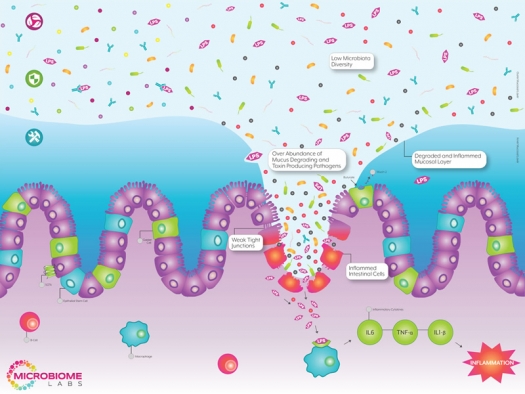 illustration of leaky gut